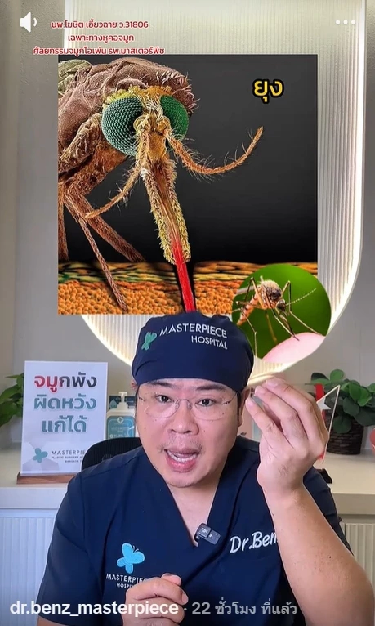 หมอเบนซ์ เตือน แยกให้ออก "ยุงหรือคุ่นกัด" พลาดเกาเสี่ยงติดเชื้อ
