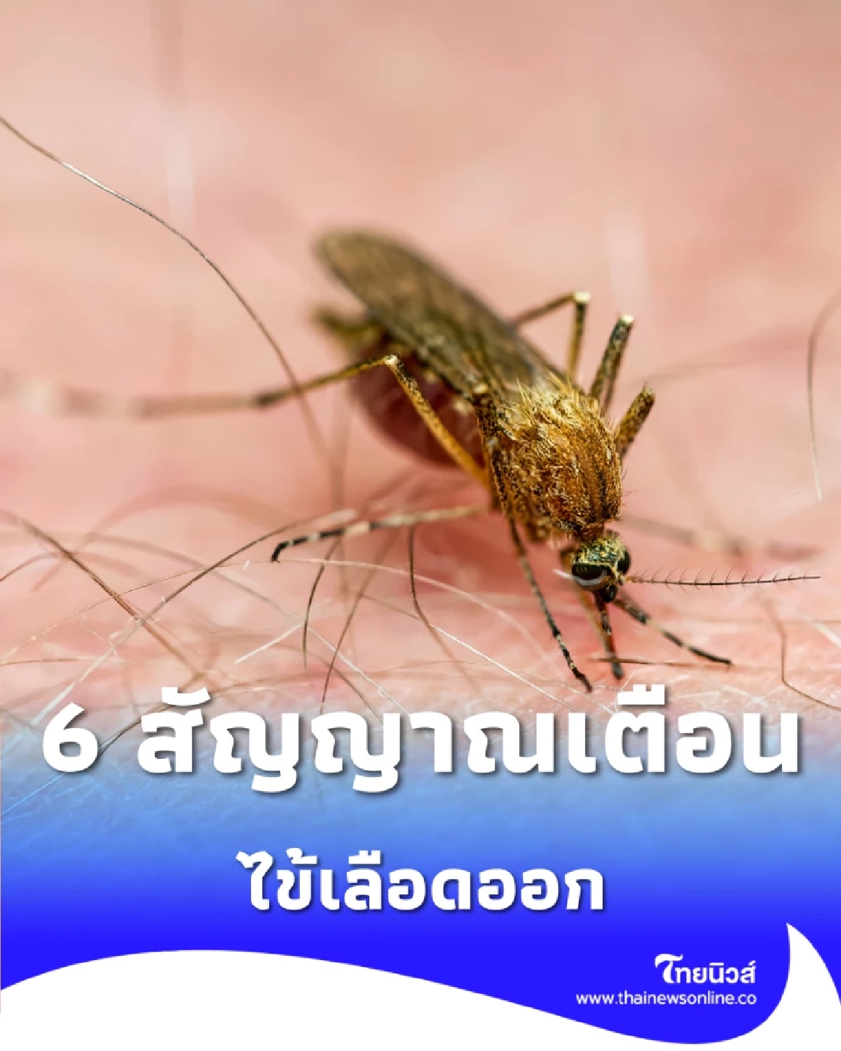 6 สัญญาณเตือนภัย ไข้เลือดออก อย่าชะล่าใจ รีบหาหมอด่วน