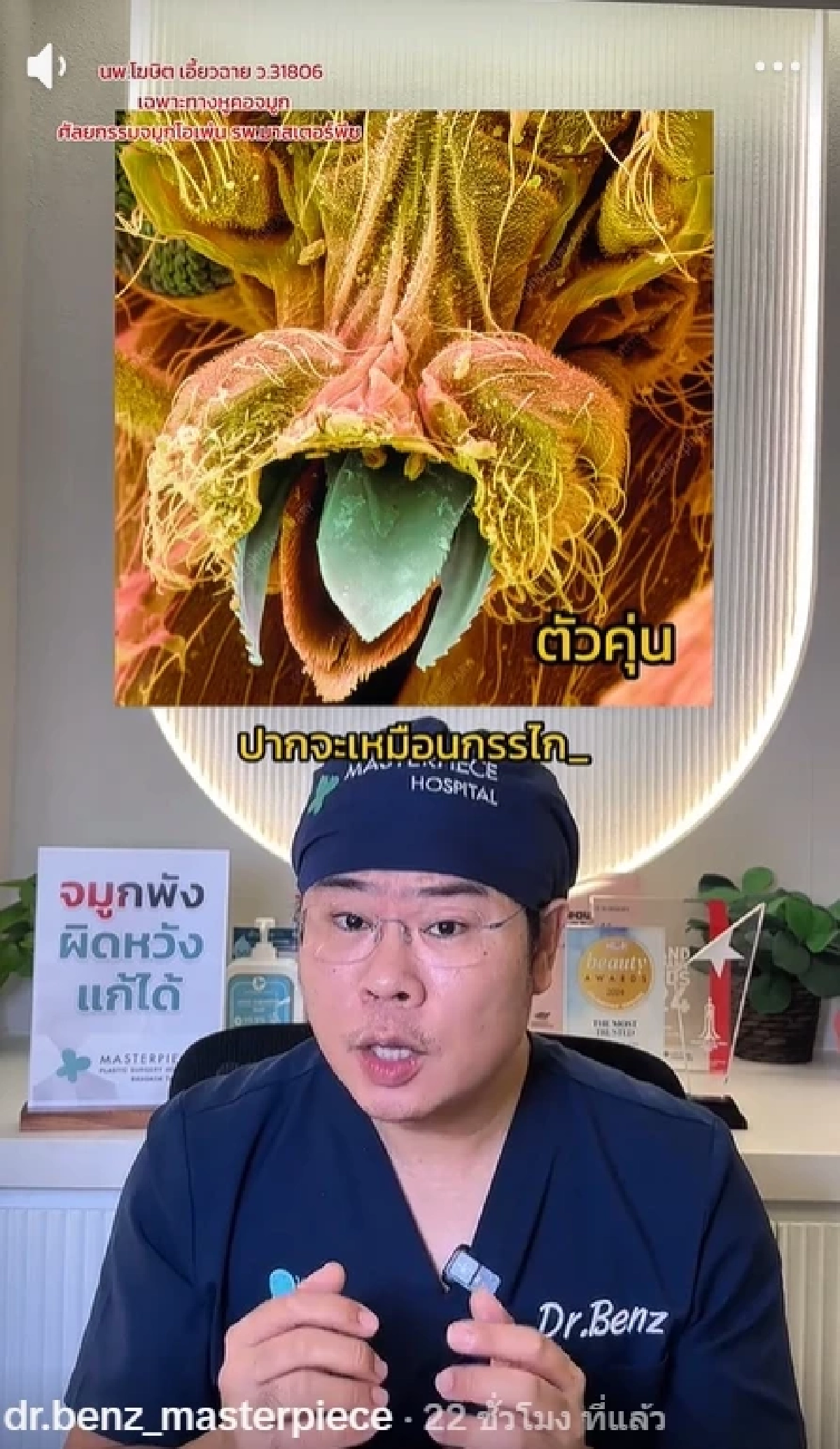 หมอเบนซ์ เตือน แยกให้ออก "ยุงหรือคุ่นกัด" พลาดเกาเสี่ยงติดเชื้อ