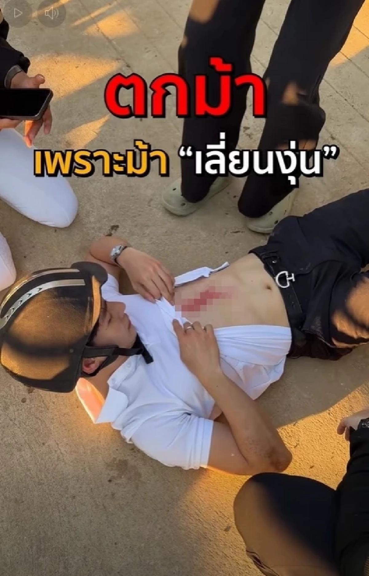 เปิดสาเหตุ "ยูทูบเบอร์ดัง" ตกม้าเจ็บหนัก รอดปาฏิหาริย์