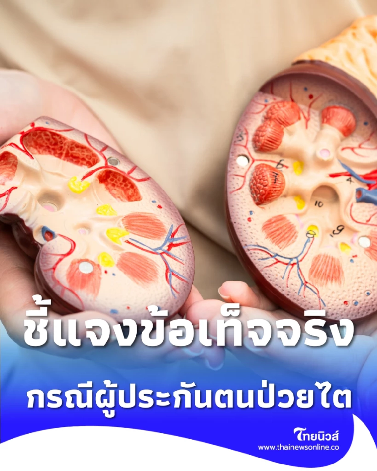 ประกันสังคมแจงยิบสิทธิรักษาไตวายเรื้อรัง เร่งตรวจสอบพร้อมให้ความช่วยเหลือ