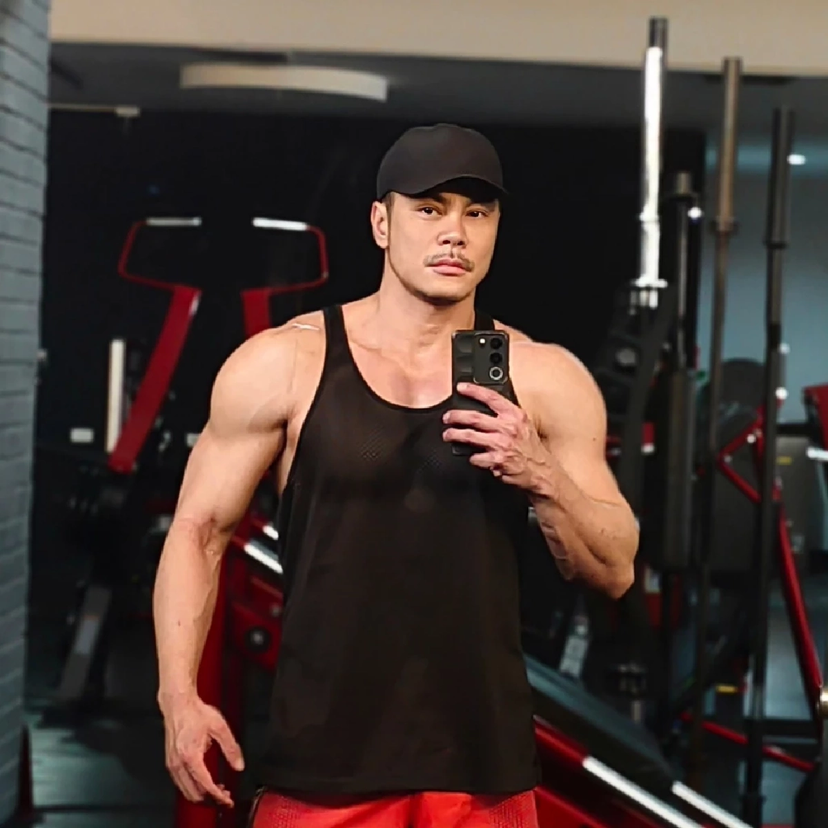 ย้อนโพสต์ แม็ค รชต แชร์ประสบการณ์ต่อสู้มะเร็งหายาก ระยะสุดท้าย