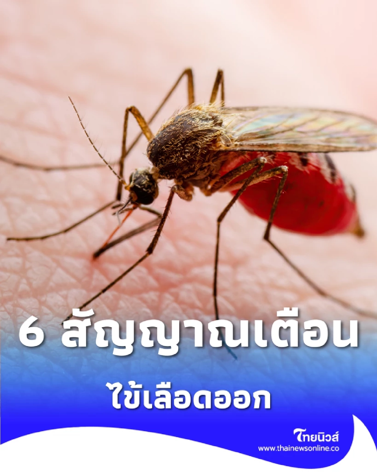 6 สัญญาณเตือนภัย ไข้เลือดออก อย่าชะล่าใจ รีบหาหมอด่วน