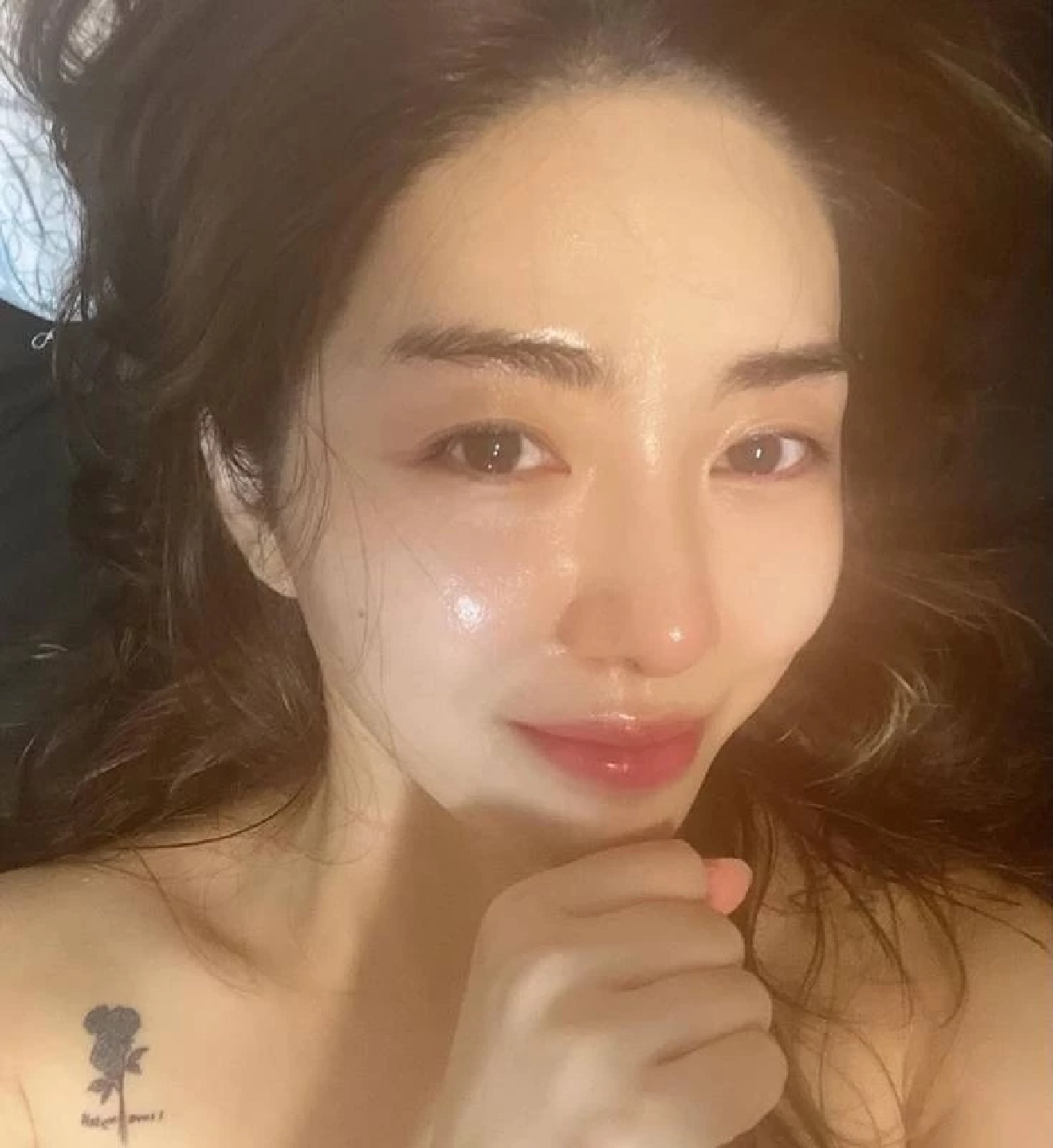 อดีตไอดอลคนดัง หน้าพังไฟไหม้ พีกกว่าคือคำพูดของผู้บริหารคลินิก