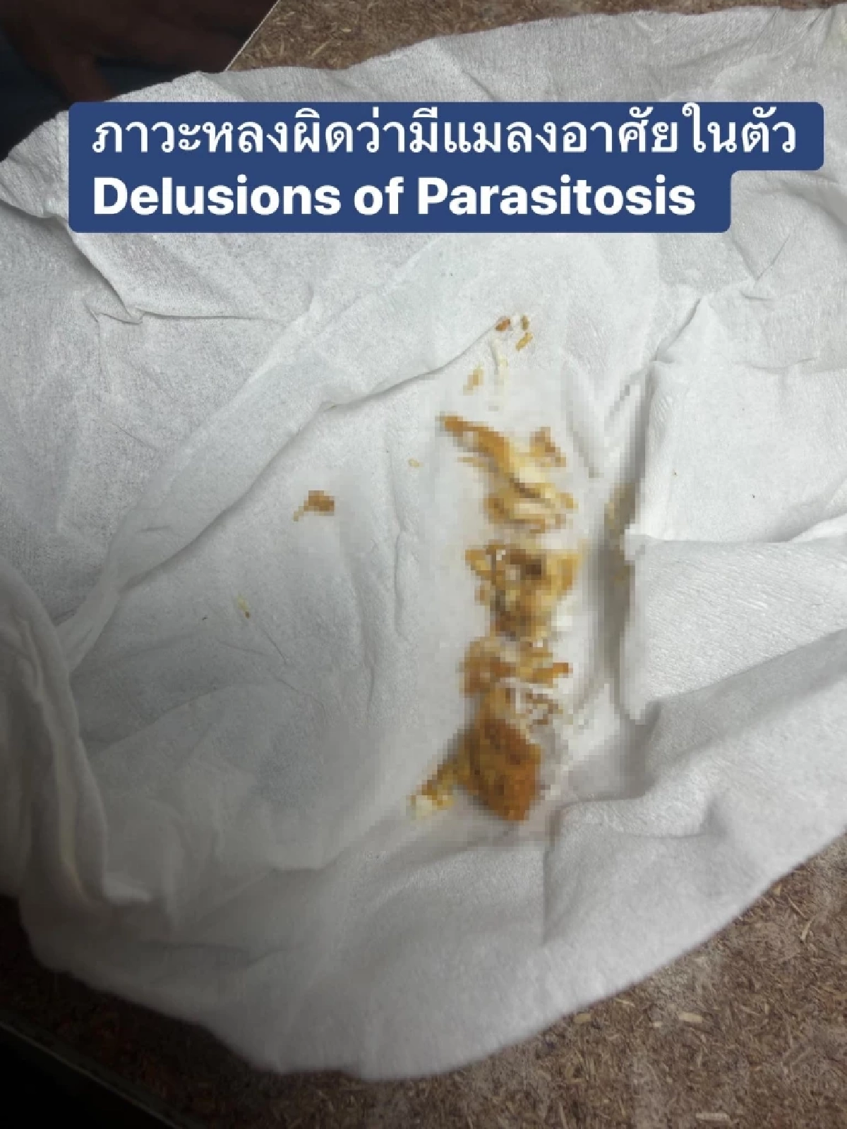หมอเฉลยแล้ว เคสคนไข้เชื่อมีแมลงไต่ทั้งตัว แท้จริงคืออะไร