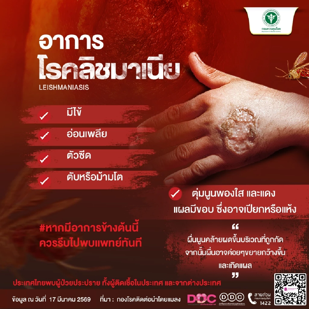 ระวัง โรคลิชมาเนีย ภัยร้ายจากริ้นฝอยทราย เช็กวิธีป้องกัน