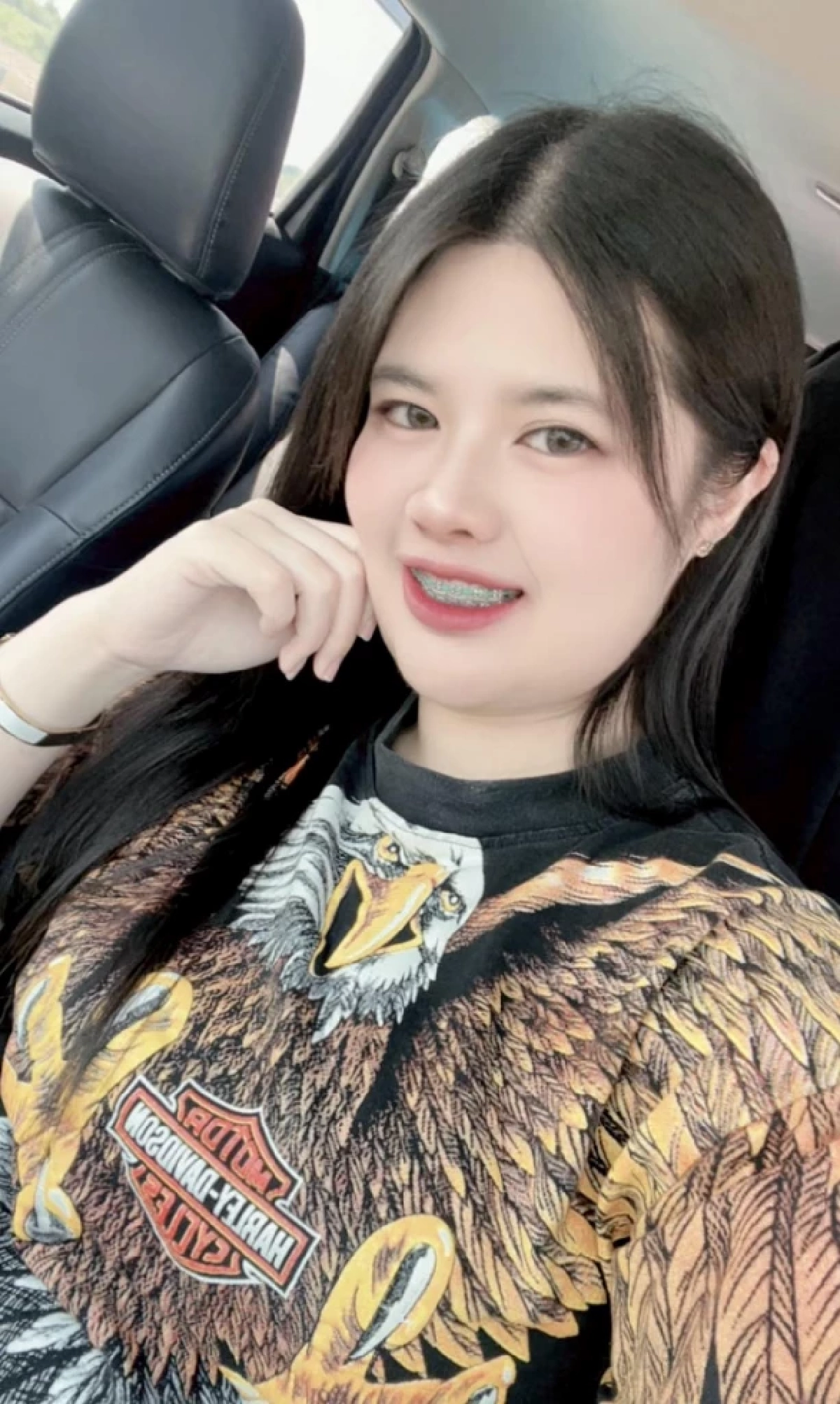 สลดหนัก เมียเล่าทั้งน้ำตา ทำไม เหน่ง เหม่งจ๋าย ไม่ยอมรักษา 