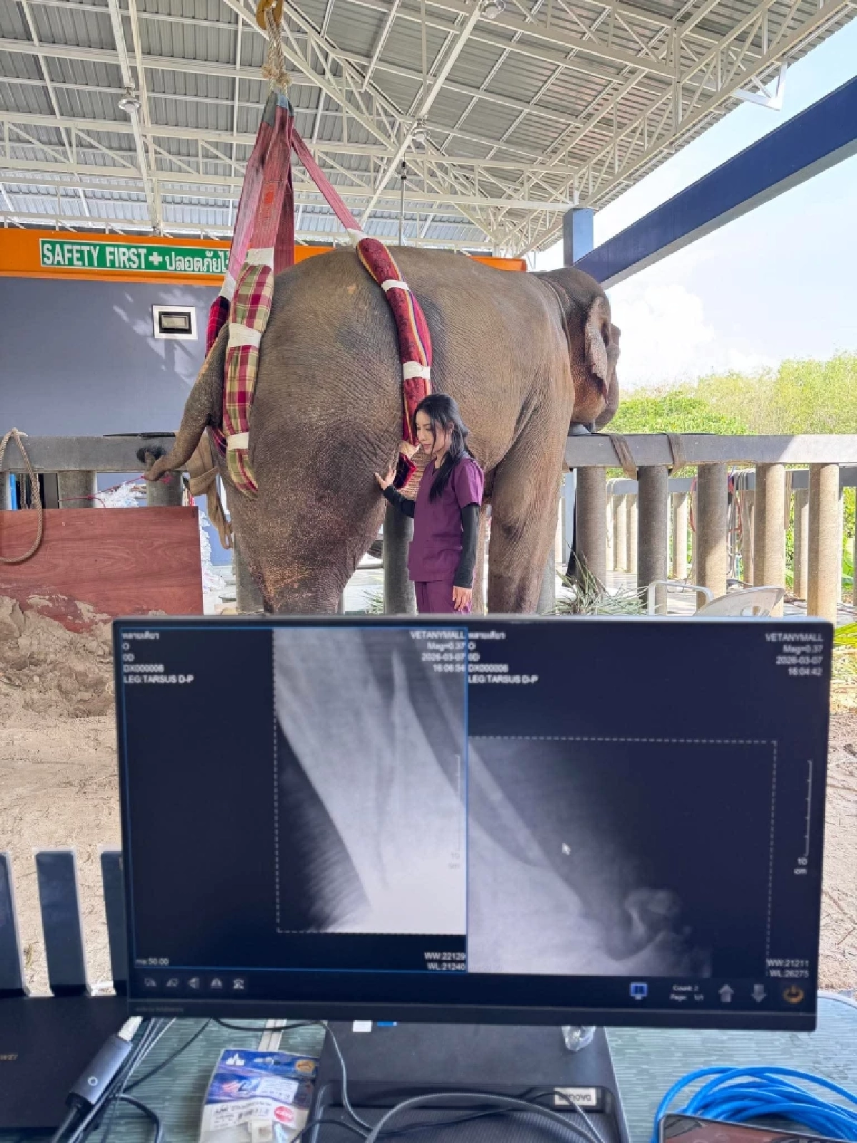 อัปเดตอาการ "พลายเดียว" ช้างขาหัก 35 วัน พบกระดูกใหม่เริ่มงอก