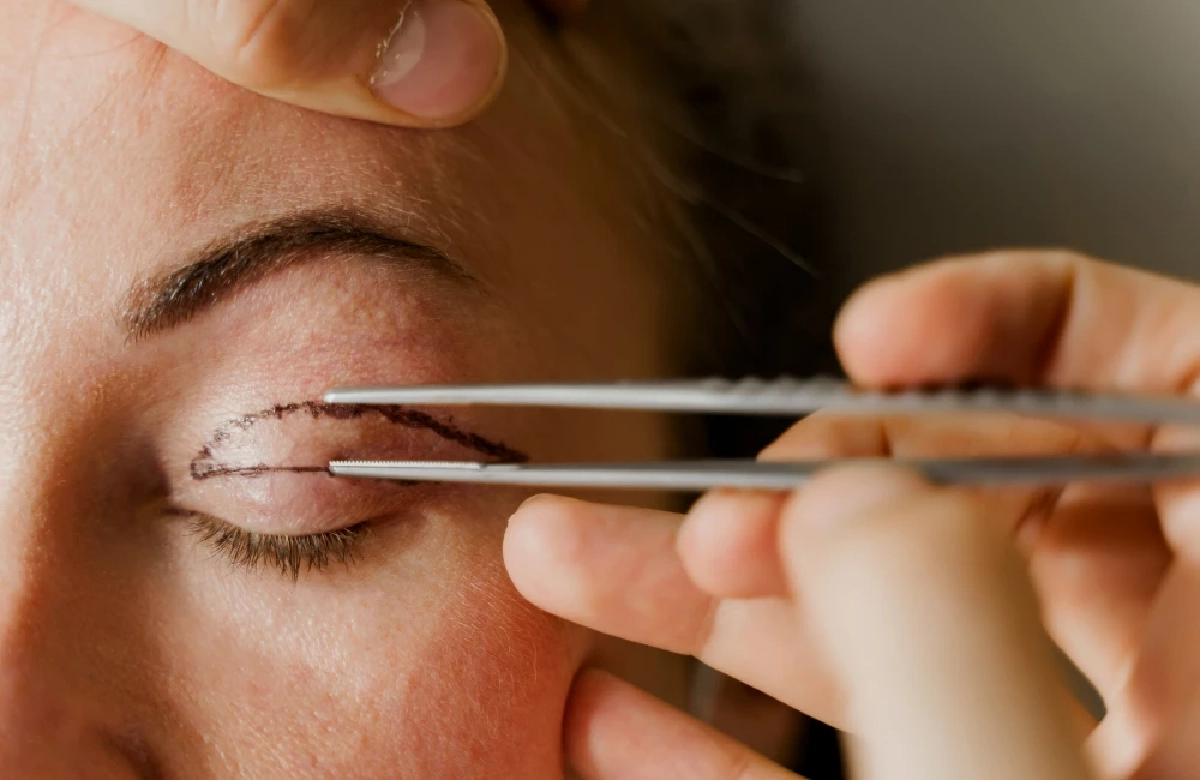 วิธีแก้ไขกล้ามเนื้อตาอ่อนแรง