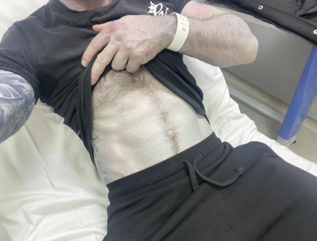 หนุ่มหลับยาว 14 ชม. ตื่นขึ้นตัวกลายเป็นสีฟ้า ผลตรวจออกมาทำตกใจ