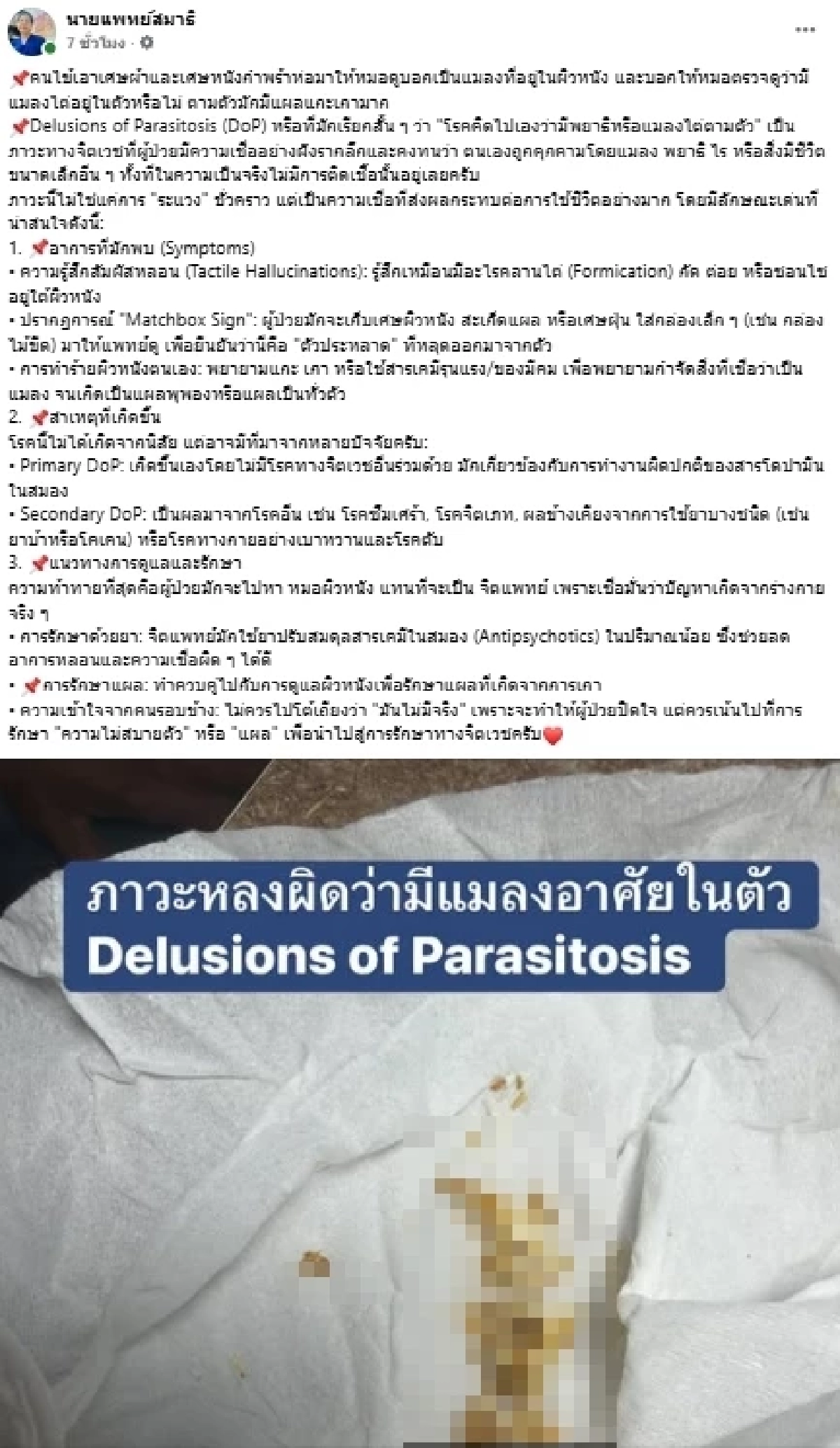 หมอเฉลยแล้ว เคสคนไข้เชื่อมีแมลงไต่ทั้งตัว แท้จริงคืออะไร