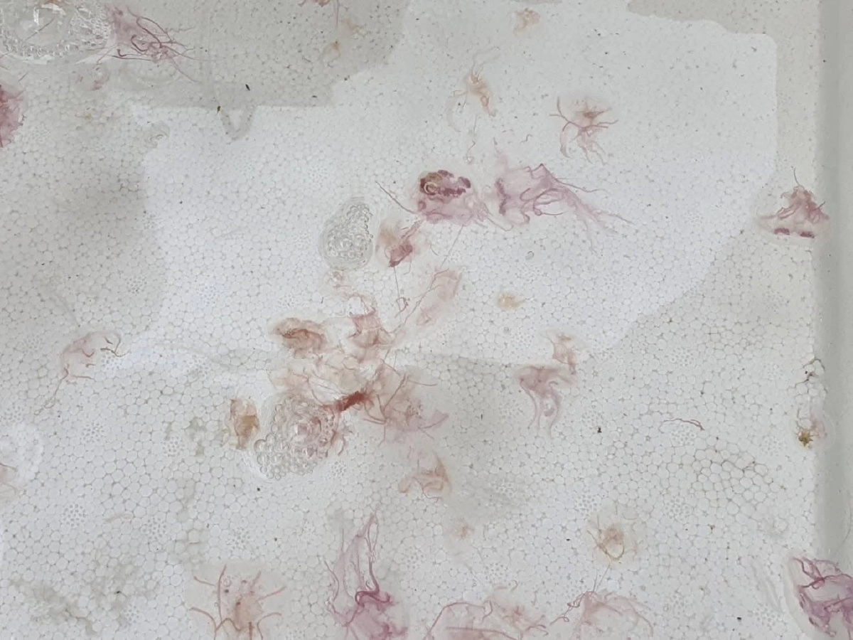 ภูเก็ตเตือน! แมงกะพรุนไฟบุกเกาะไม้ท่อน สั่งงดเล่นน้ำชั่วคราว