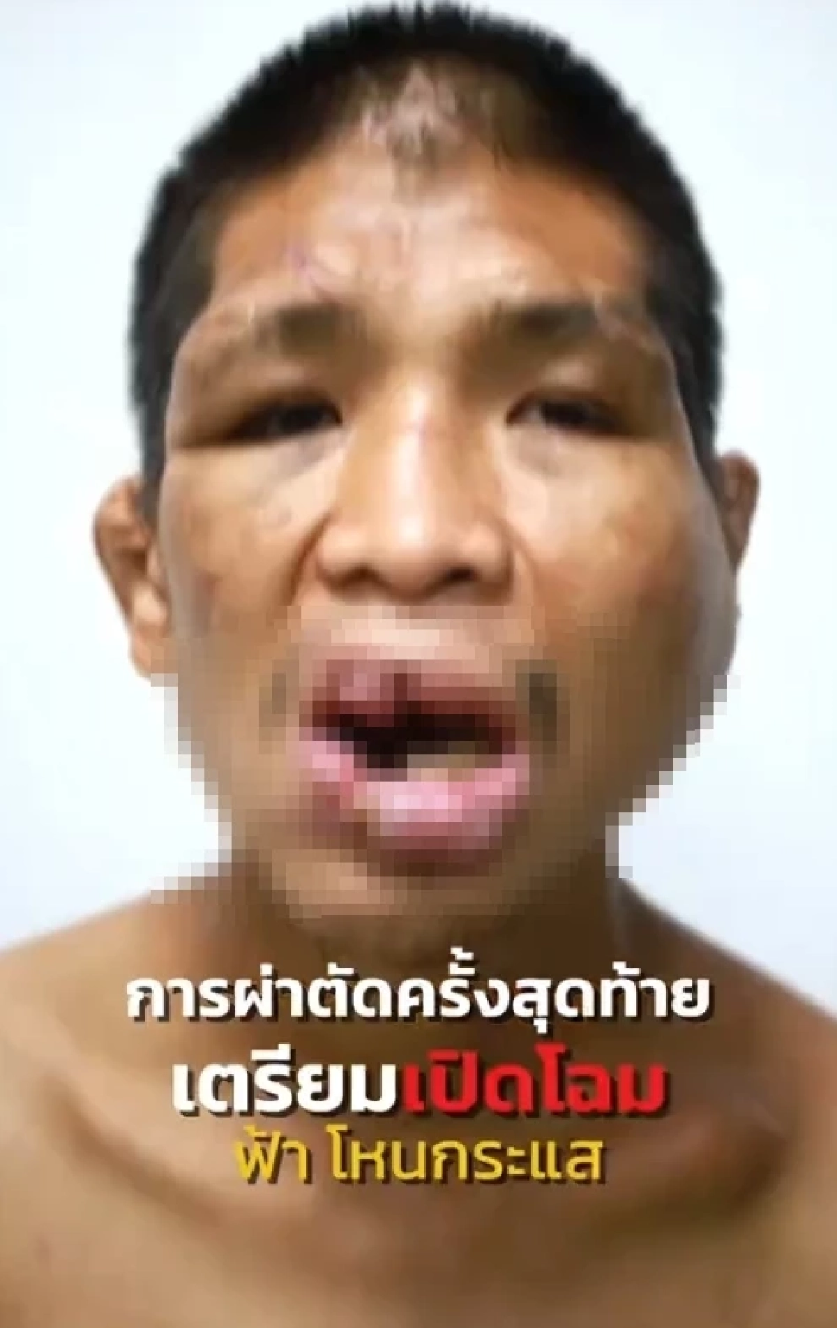 จำได้ไหม "น้องฟ้า โหนกระแส" เหยื่อนายจ้างโหด ล่าสุดหล่อขึ้นมาก