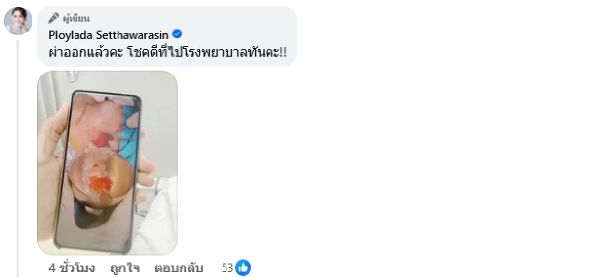 ใครชอบกินต้องระวัง กุ้งแช่น้ำปลาทำพิษ ต้องผ่าตัด นอนแอดมิท 10 วัน