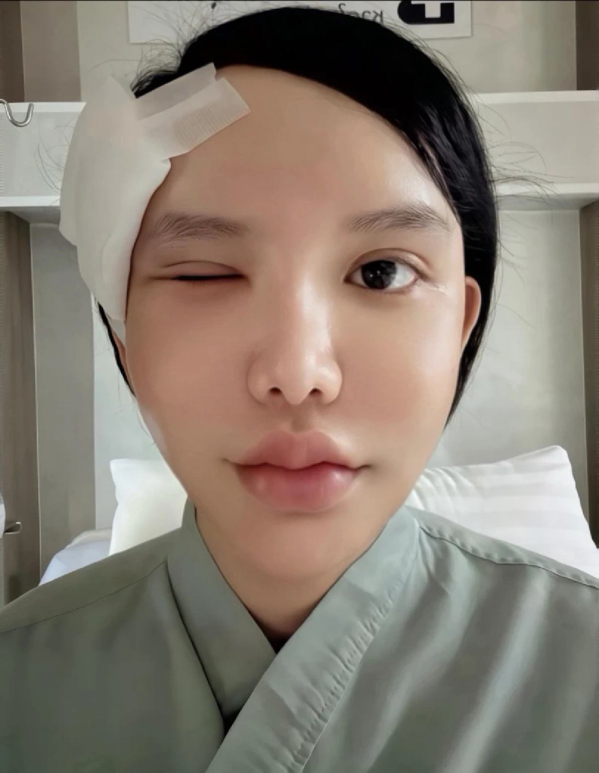 ใครชอบกินต้องระวัง กุ้งแช่น้ำปลาทำพิษ ต้องผ่าตัด นอนแอดมิท 10 วัน