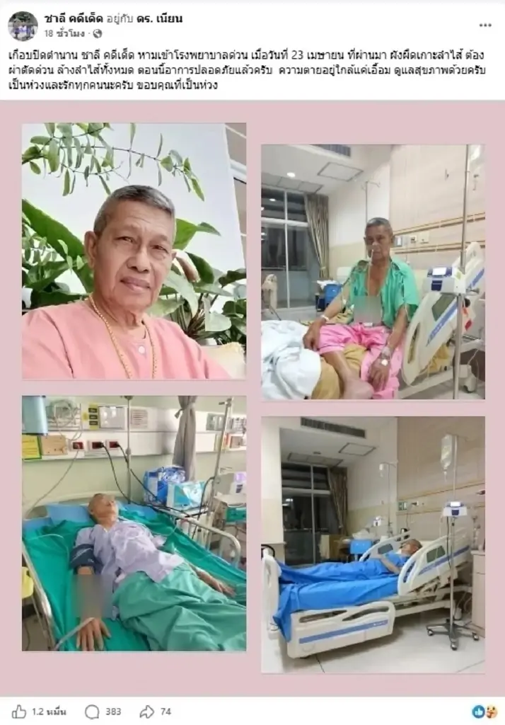 เกือบปิดตำนาน เปิดอาการ "ชาลี คดีเด็ด" หลังผ่าตัดล้างลำไส้ด่วน