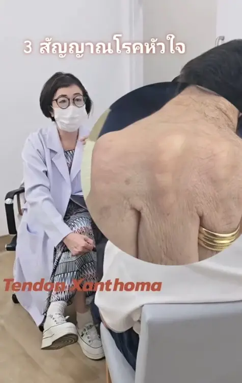หมอฝากถึง "เจมส์ จิรายุ" รีบเช็ก 3 จุดบนร่างกาย หลังคอเลสเตอรอลสูง