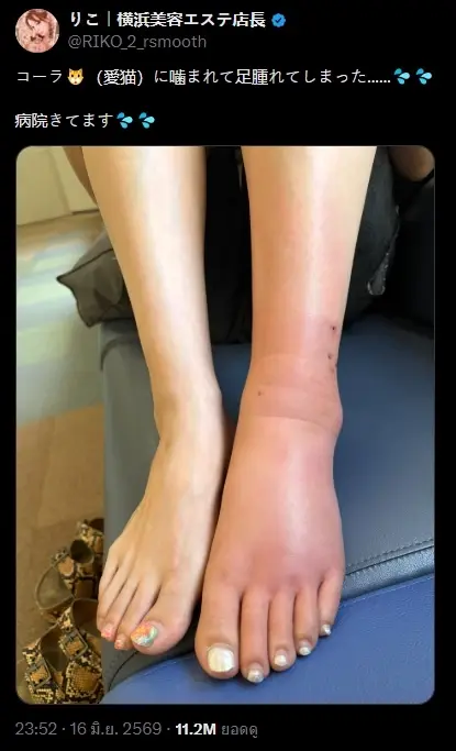 อย่าคิดว่าแค่นิดเดียว  สาวแชร์ภาพขาบวมเป่ง หลังถูกแมวตัวเองกัด