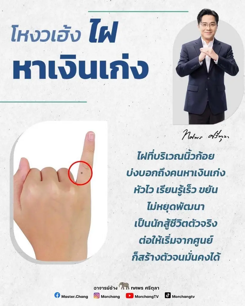 ไฝที่นิ้วมือ ไฝที่นิ้วก้อย ความเชื่อไฝ หมอช้าง ไทยมู