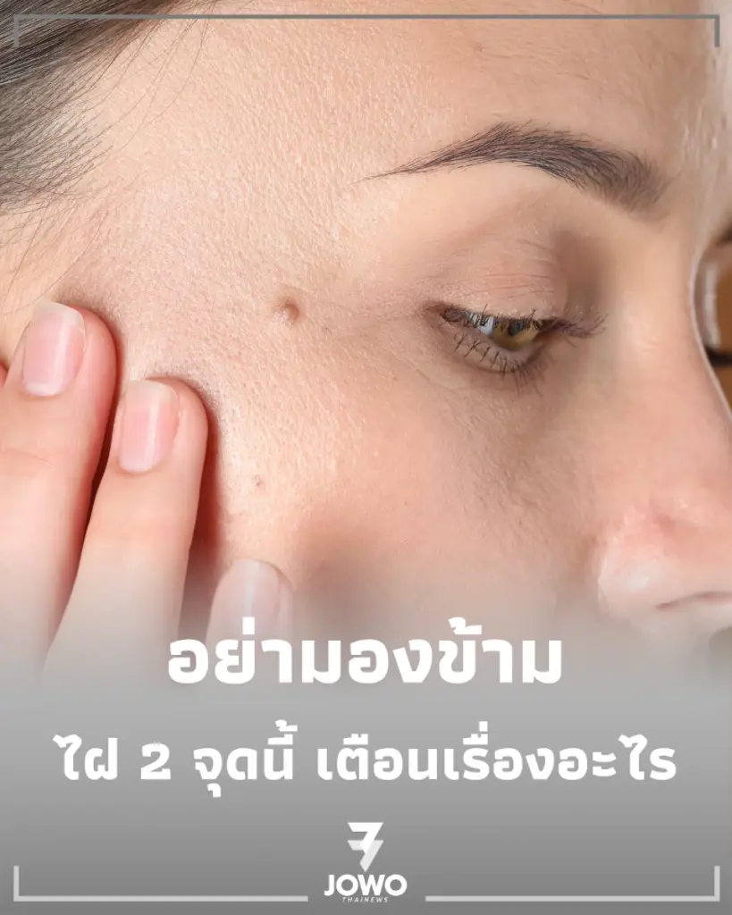 เปิดคำทำนาย ไฝที่คิ้ว-ใต้ตา จุดเปลี่ยนชีวิตที่หลายคนมองข้าม