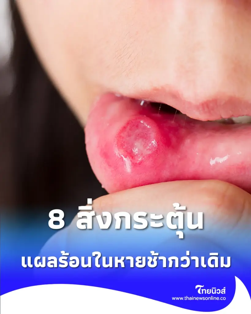 เปิด 8 วิธีทำให้หายเร็ว พร้อมเคล็ดลับดูแลช่องปากที่ถูกต้อง