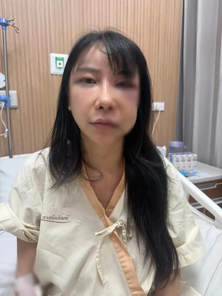 "มิรา" เผยสาเหตุแท้จริง "สุภาพบุรุษตัวลาย" รัวหมัดใส่เขียวช้ำ