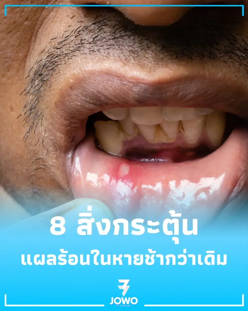 เปิด 8 วิธีทำให้หายเร็ว พร้อมเคล็ดลับดูแลช่องปากที่ถูกต้อง