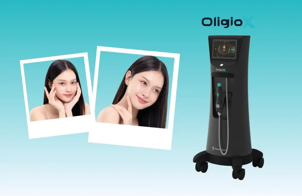 จุดเด่นของ Oligio X