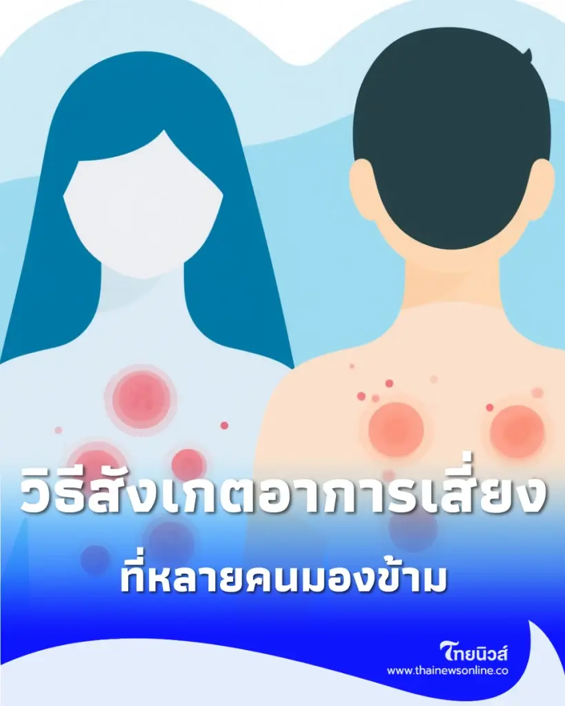 เปิดลักษณะ ผื่น HIV ระยะแรก รูปทรงแบบไหน ควรรีบพบแพทย์ตรวจเลือดด่วน