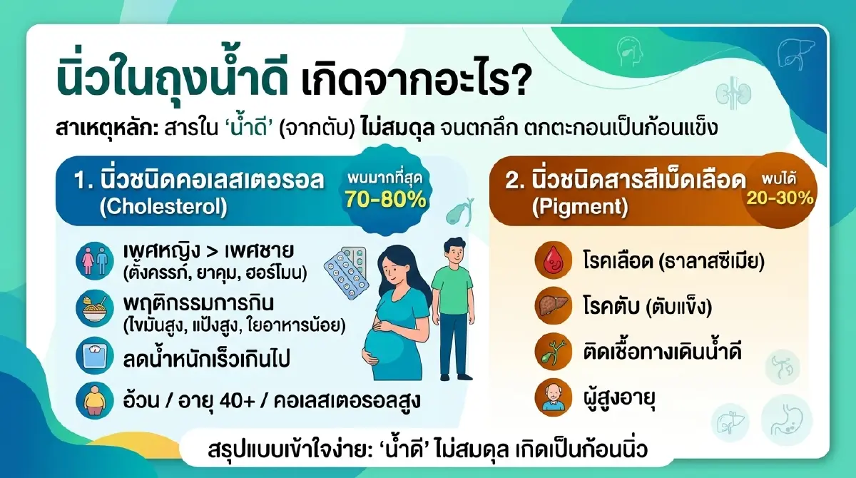 รู้ไหม พฤติกรรมที่คุณทำอยู่ทุกวัน อาจสร้างก้อนนิ่ว โดยไม่รู้ตัว