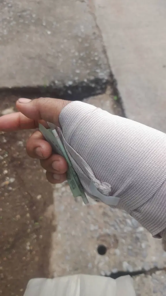 สุดทน! สุนัขจรจัดชัยภูมิไล่กัดคน จยย.ล้มเจ็บนับสิบ
