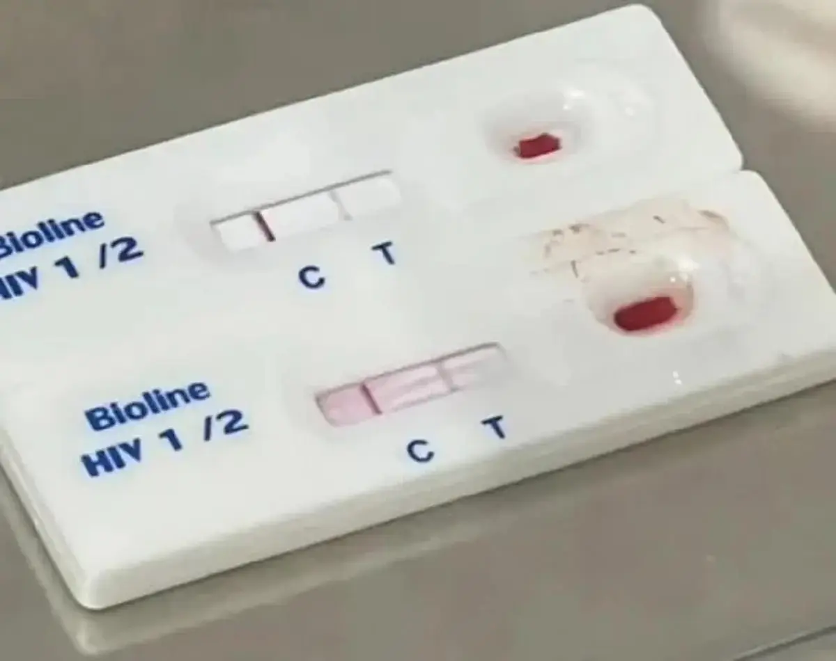 HIV ตรวจเองได้แล้ว เปิดวิธีเช็กเบื้องต้น ใครเสี่ยงเช็กด่วน