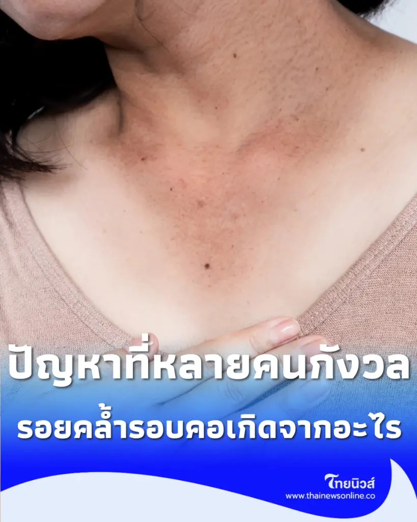 อย่ามองข้ามผิวรอบคอ รวม 6 เคล็ดลับดูแลผิวให้ดูสุขภาพดีด้วยวิธีธรรมชาติ