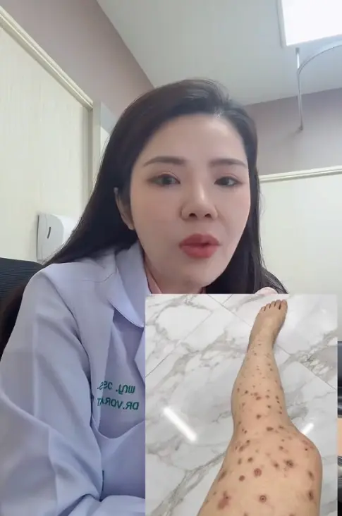 หมอเมย์ เผยสาเหตุแท้จริง นายจ้างติดวัณโรคปอด หลังรู้แม่บ้านป่วย HIV
