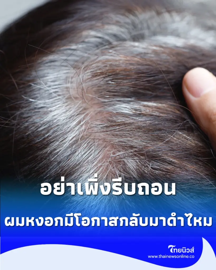 ผมหงอก อย่าเพิ่งรีบถอน เช็กให้ชัวร์ยังมีโอกาสกลับมาดำไหม