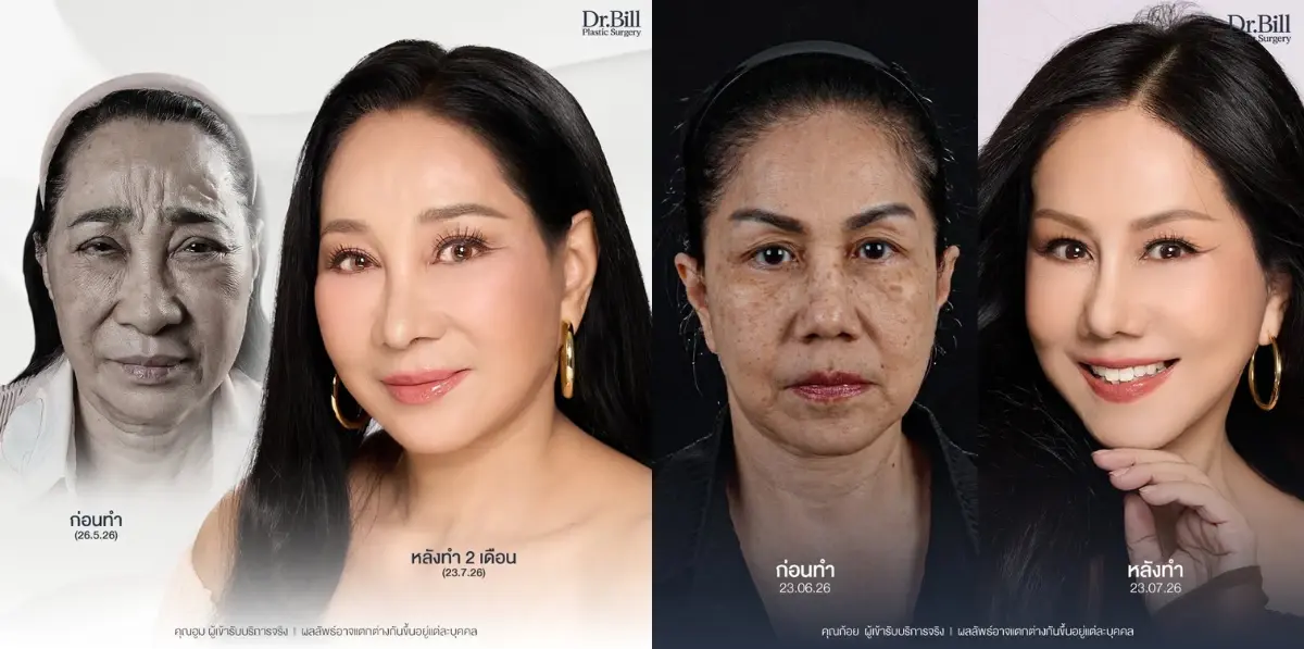 สองนักแสดงรุ่นใหญ่ เปิดใจ อายุไม่ใช่อุปสรรค ศัลยกรรมดึงหน้า 
