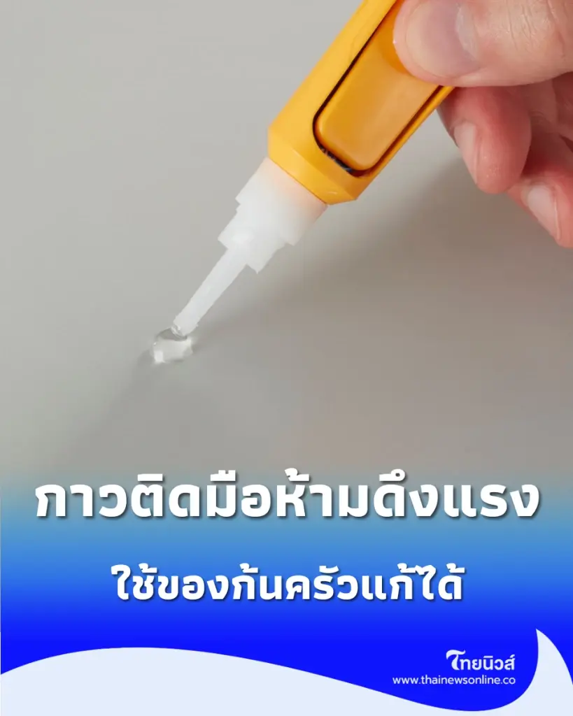 เผยทริคเด็ด "กาวติดมือ" ห้ามดึงแรง ใช้สิ่งนี้หลุดออกง่าย