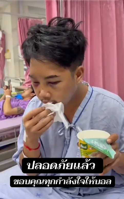 เห็นแล้วตกใจ "บอล โดเรม่อน" ใบหน้าล่าสุด หลังประสบอุบัติเหตุ