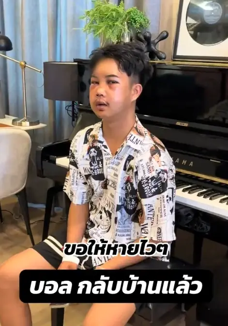เห็นแล้วตกใจ "บอล โดเรม่อน" ใบหน้าล่าสุด หลังประสบอุบัติเหตุ