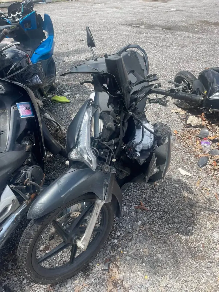 เห็นแล้วตกใจ "บอล โดเรม่อน" ใบหน้าล่าสุด หลังประสบอุบัติเหตุ