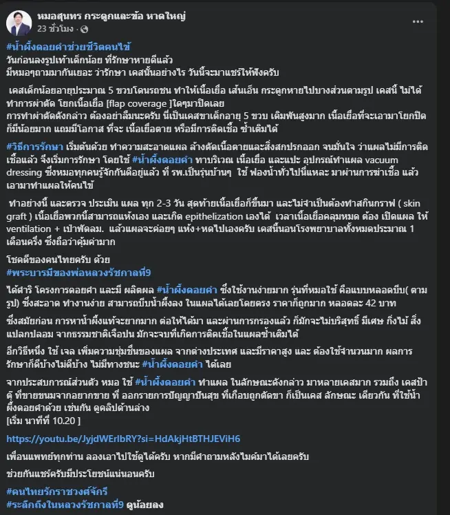 หมอเปิดเคส เด็ก 5 ขวบ มีแผลลึก เผยผลรักษาด้วยน้ำผึ้งดอยคำ