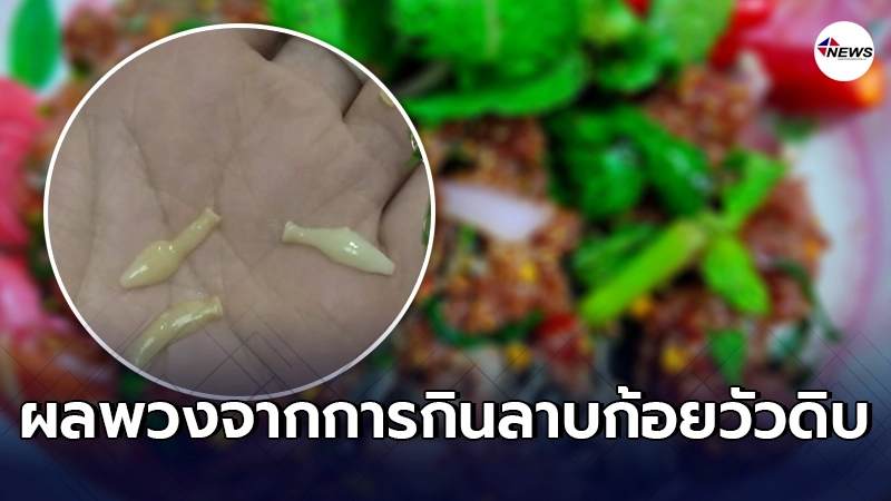 ศูนย์วิจัยฯเผยภาพ ปล้องสุกของพยาธิตืด ออกมาจากผู้ที่กิน ลาบก้อยวัวดิบ ศูนย์วิจัยฯเผยภาพ ปล้องสุกของพยาธิตืด ออกมาจากผู้ที่กิน ลาบก้อยวัวดิบ
