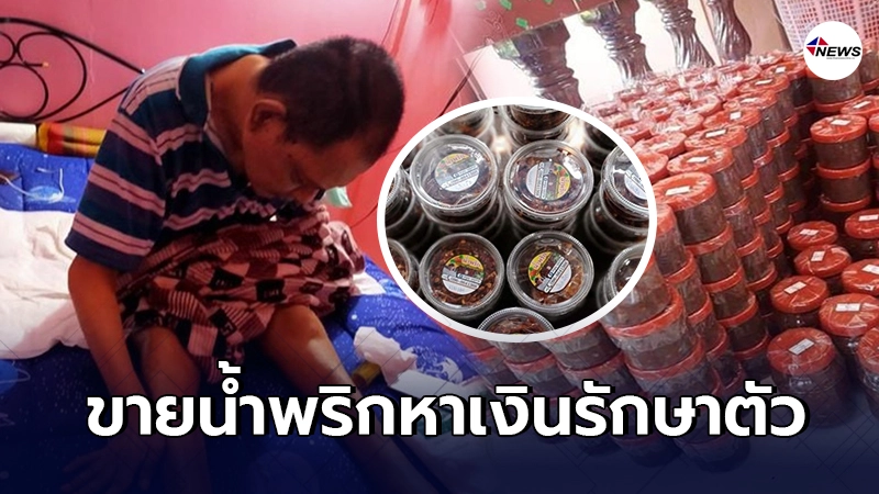 ชายป่วยติดเตียงนาน 22 ปี ไม่ยอมแพ้ต่อโชคชะตา ขายน้ำพริกหาเงินรักษาตัว ชายป่วยติดเตียงนาน 22 ปี ไม่ยอมแพ้ต่อโชคชะตา ขายน้ำพริกหาเงินรักษาตัว