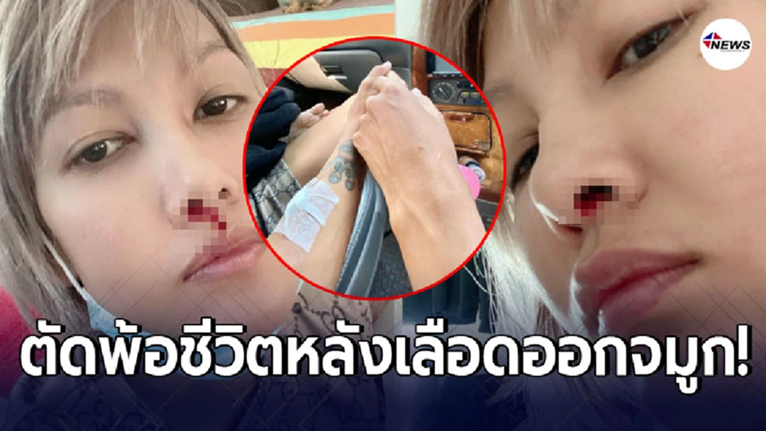 หญิง อภิสรา ภรรยา เเจ๊ค เชิญยิ้ม โพสต์ตัดพ้อชีวิต หลังเลือดไหลออกจมูก