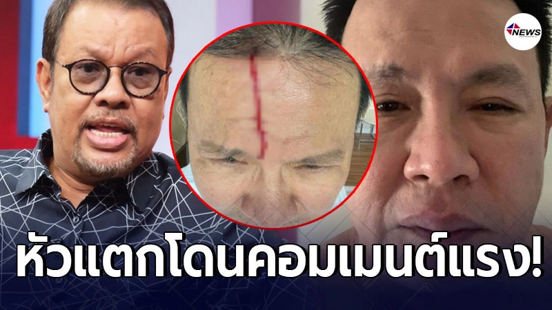 โน้ต เชิญยิ้ม โผล่คอมเมนต์แรง จตุรงค์ หลังชนขอบประตูจนหัวแตก โน้ต เชิญยิ้ม โผล่คอมเมนต์แรง จตุรงค์ หลังชนขอบประตูจนหัวแตก