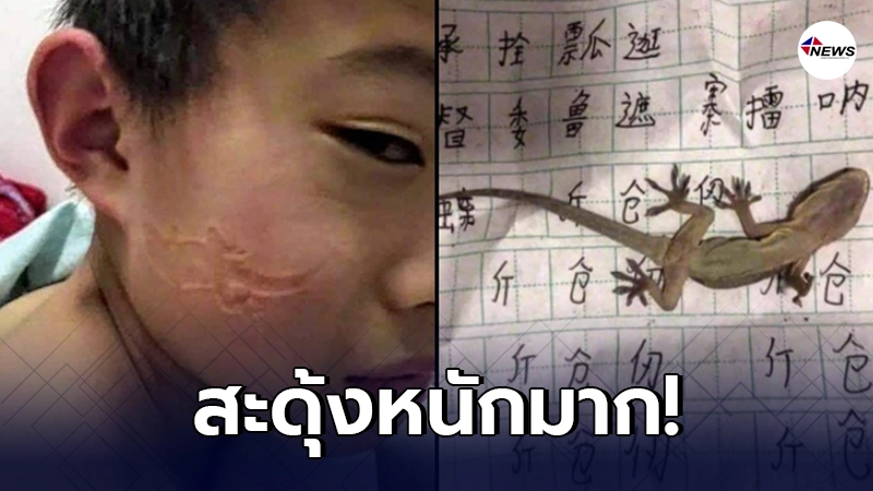 เด็กชายชาวจีน ง่วงหลับคาหนังสือ ตื่นมาถึงกับสะดุ้ง หลังเห็นรอยข้างแก้ม เด็กชายชาวจีน ง่วงหลับคาหนังสือ ตื่นมาถึงกับสะดุ้ง หลังเห็นรอยข้างแก้ม