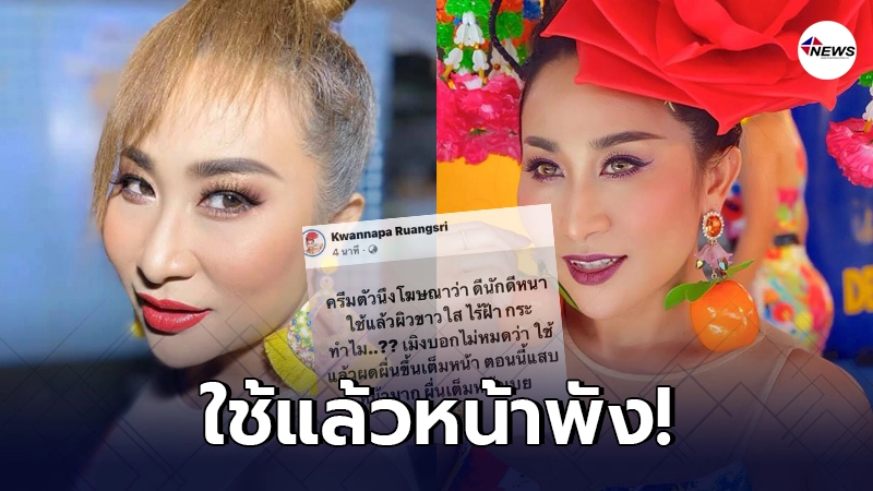 ลาล่า อาร์สยาม เดือด ใช้ครีมหน้าขาวโฆษณาอย่างดีสุดท้ายหน้าพัง ลาล่า อาร์สยาม เดือด ใช้ครีมหน้าขาวโฆษณาอย่างดีสุดท้ายหน้าพัง