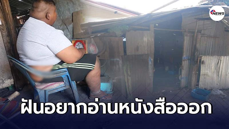 หนุ่มวัย 16 สุดลำบากน้ำหนักตัวผิดปกติ ไม่ได้เรียนหนังสือเพราะฐานะยากจน