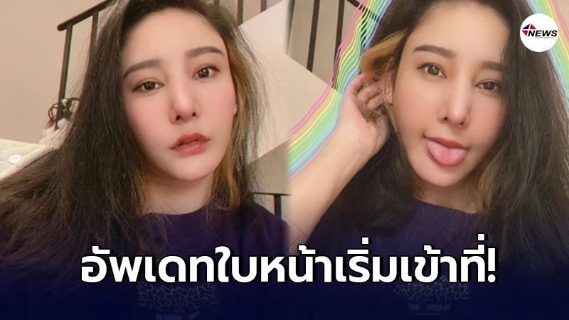 แตงโม นิดา อัพเดทใบหน้าล่าสุด หลังจมูกเริ่มเข้าที่ แตงโม นิดา อัพเดทใบหน้าล่าสุด หลังจมูกเริ่มเข้าที่