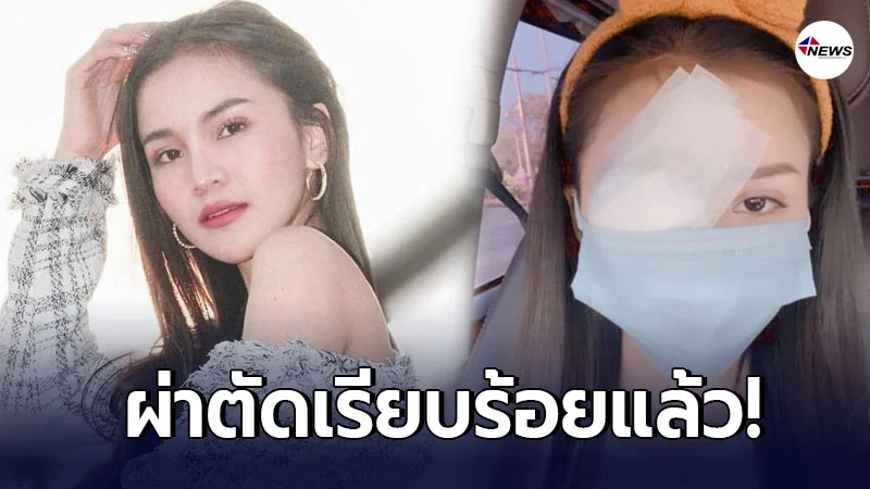 ชาวเน็ตเป็นห่วง อาม ชุติมา หลังโพสต์รูปปิดตาข้างหนึ่ง ชาวเน็ตเป็นห่วง อาม ชุติมา หลังโพสต์รูปปิดตาข้างหนึ่ง